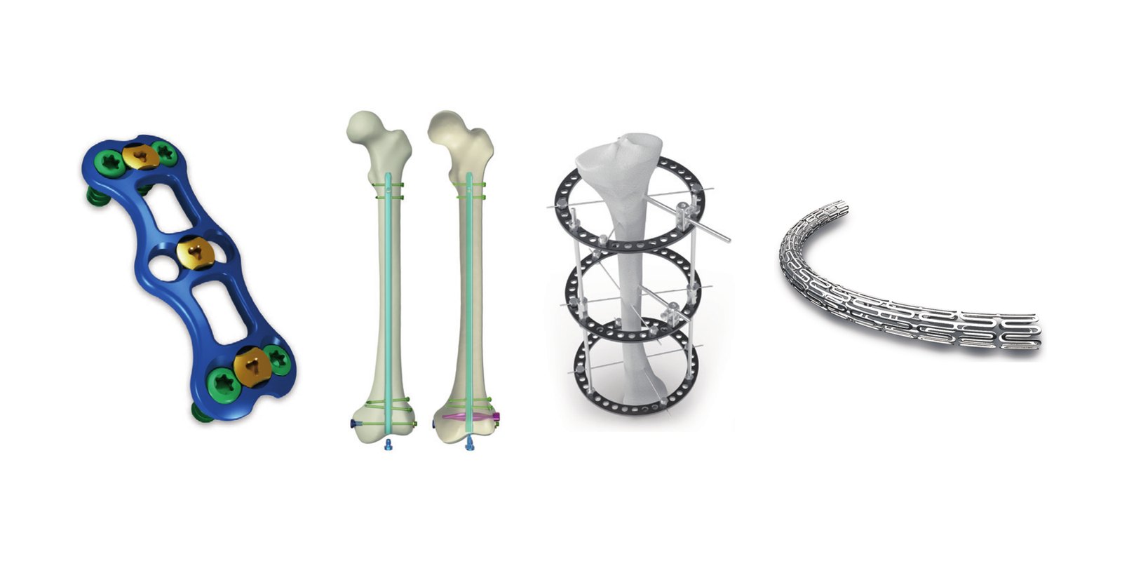 Orthopedic Implants & Surgical Devices